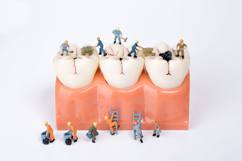 歯の移植（自家歯牙移植）
