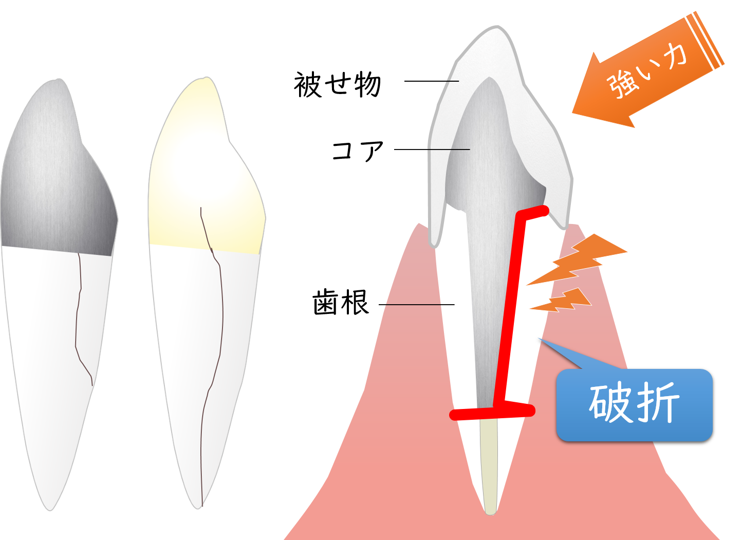 みよし市東陣取山の歯医者、後藤歯科の歯科用ＣＴ