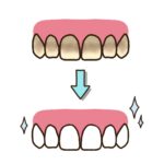 みよし市　歯医者　歯の黄ばみの対処法　後藤歯科